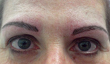 Cosmetic tatoo hair stroke brows after