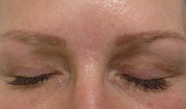 Cosmetic tattoo hair stroke brows - Before