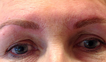 Cosmetic tattoo hair stroke brows a before